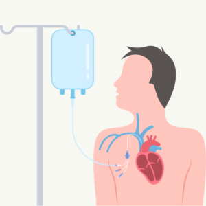 Central-Line Associated Bloodstream Infections